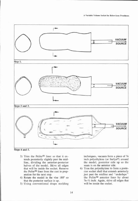 A Variable Volume Socket for Below-knee Prostheses