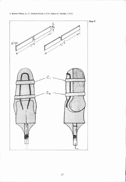 A Variable Volume Socket for Below-knee Prostheses