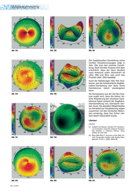 Möglichkeiten der Hornhautdiagnostik - Oculus