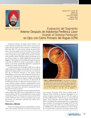 Evaluación del Segmento Anterior Después de Iridotomía ... - Oculus