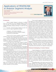 Applications of PENTACAM in Anterior Segment Analysis - Oculus