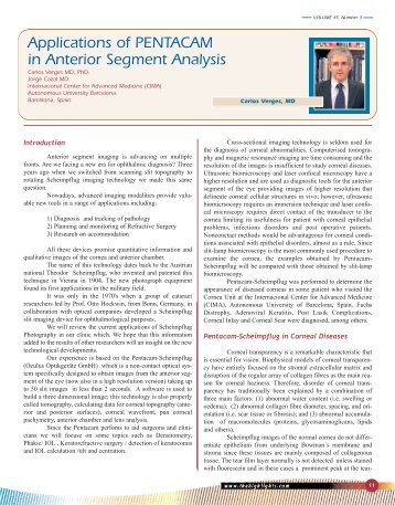 Applications of PENTACAM in Anterior Segment Analysis - Oculus