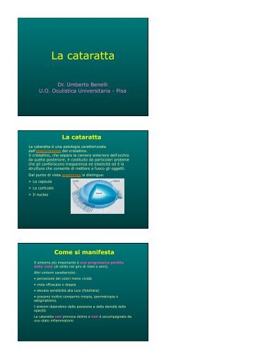 La cataratta - Clinica Oculistica Universitaria di Pisa