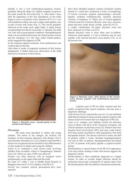 download full issue - Our Dermatology Online Journal