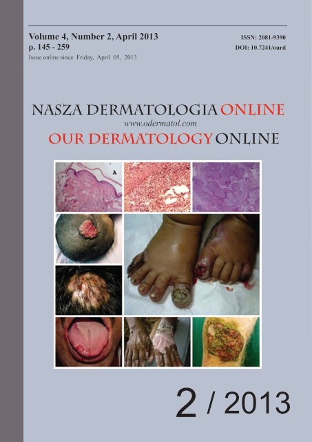 download full issue - Our Dermatology Online Journal