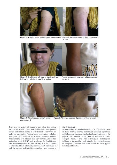 download full issue - Our Dermatology Online Journal