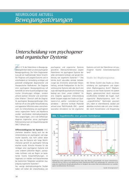 neurologisch - Ãsterreichische Gesellschaft fÃ¼r Neurologie