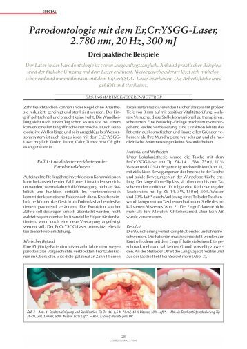 Parodontologie mit dem Er,Cr:YSGG-Laser, 2.780 nm ... - ZWP online