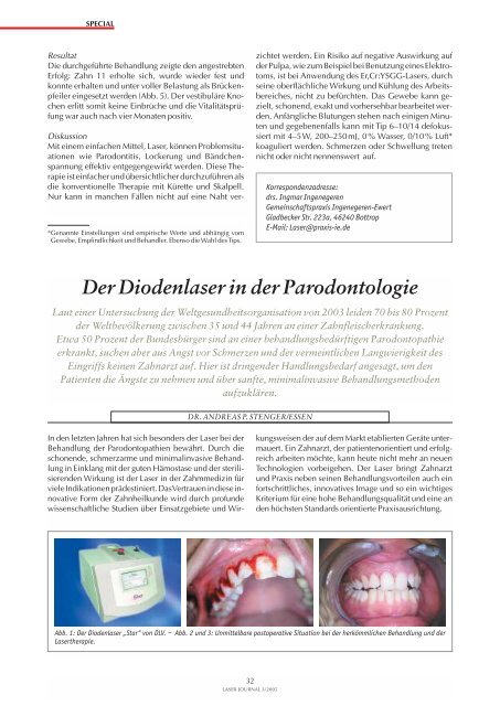 Parodontologie mit dem Er,Cr:YSGG-Laser, 2.780 nm ... - ZWP online