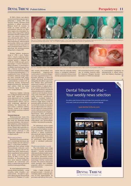 DENTAL TRIBUNE