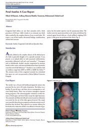 Fetal Amelia: A Case Report - OMJ