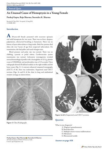 An Unusual Cause of Hemoptysis in a Young Female - OMJ