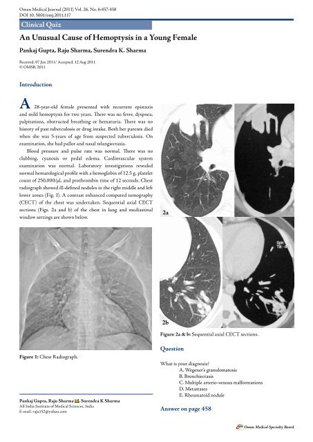 An Unusual Cause of Hemoptysis in a Young Female - OMJ
