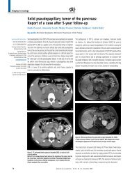 Solid pseudopapillary tumor of the pancreas: Report of a ... - doiSerbia