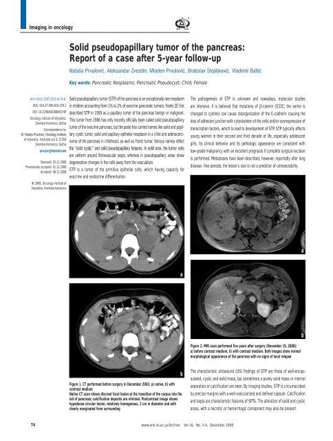 Solid pseudopapillary tumor of the pancreas: Report of a ... - doiSerbia