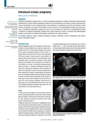 Intramural ectopic pregnancy - doiSerbia