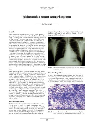 Rabdomiosarkom mediastinuma: prikaz primera - Onkološki inštitut