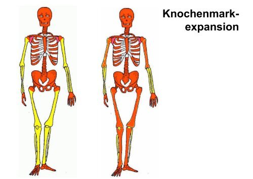 Erkrankungen der Myelopoese I - Hämatologie und Onkologie ...