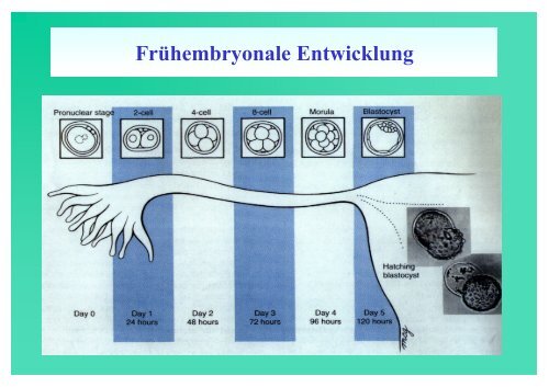 Pro und Contra PrÃ¤implantationsdiagnostik