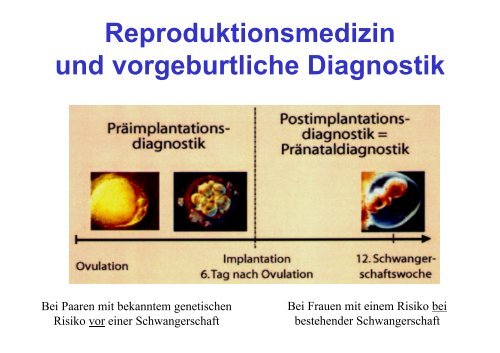 Pro und Contra PrÃ¤implantationsdiagnostik