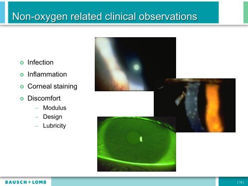 Contact Lens Drop-outs