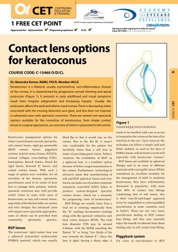 Contact lens options for keratoconus - Optometry Today