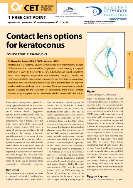 Contact lens options for keratoconus - Optometry Today