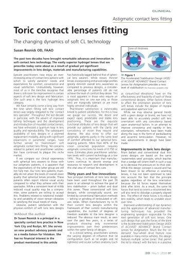 Toric contact lenses fitting - Optometry Today