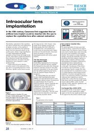 Intraocular lens implantation - Optometry Today