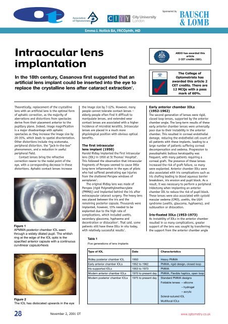 Intraocular lens implantation - Optometry Today