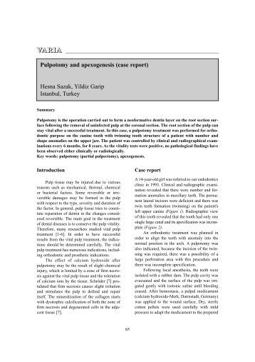 Pulpotomy and apexogenesis (case report) - Oral Health and Dental ...