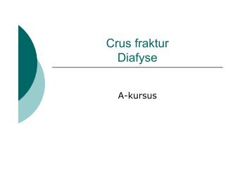 Crus fraktur Diafyse