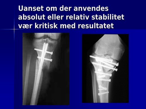 Introduktion til absolut og relativ stabilitet