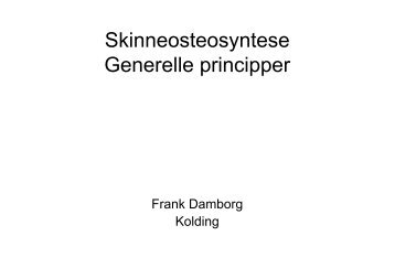 Skinneosteosyntese Generelle principper