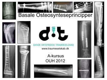 Basale orteosyntese principper 2012