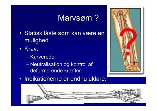 Antebrachium frakturer