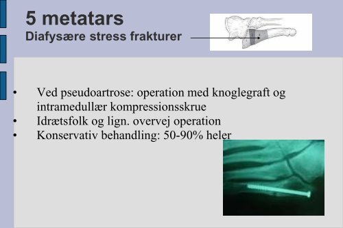 Frakturer og luksationer: calcaneus, talus, naviculare, Chopart ...