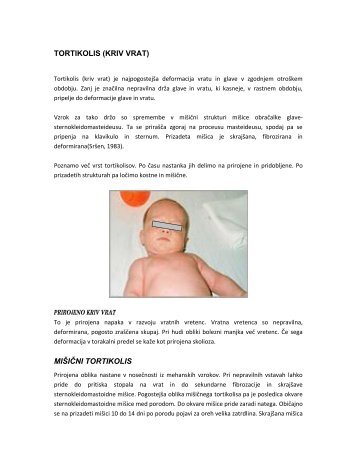 tortikolis - Ortopedska klinika Ljubljana