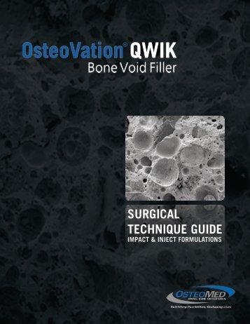 Surgical Guide - OsteoMed