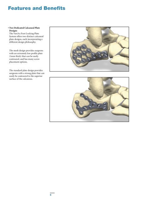 VariAx Foot Brochure - Stryker