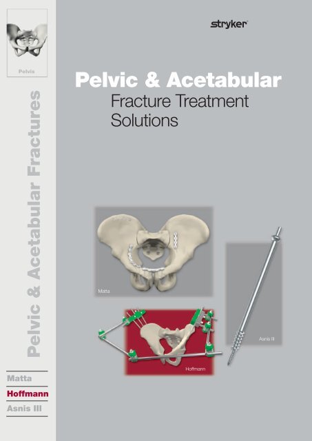 Pelvic & Acetabular Fracture Treatment Solutions - Stryker