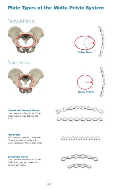 Pelvic & Acetabular Fracture Treatment Solutions - Stryker