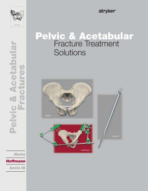 Pelvic & Acetabular Fracture Treatment Solutions - Stryker