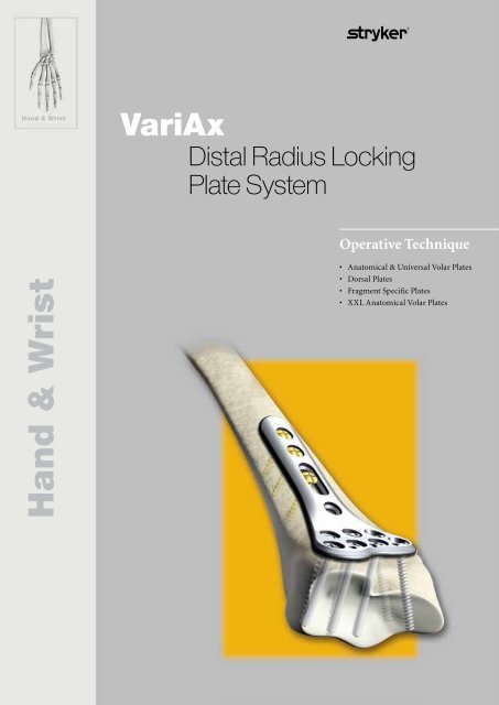 VariAx Distal Radius Op-Tech - Stryker