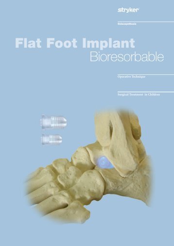 Flat Foot Implant Bioresorbable - Stryker