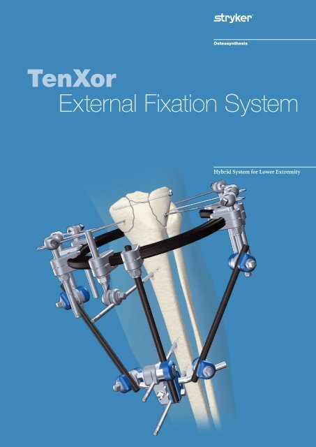 External Fixation System TenXor - Stryker