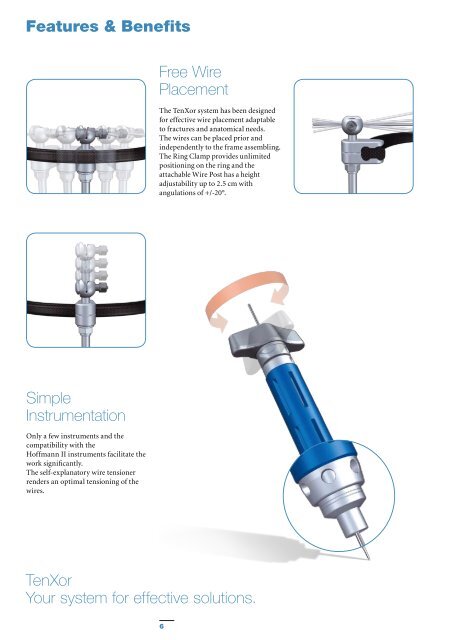 External Fixation System TenXor - Stryker