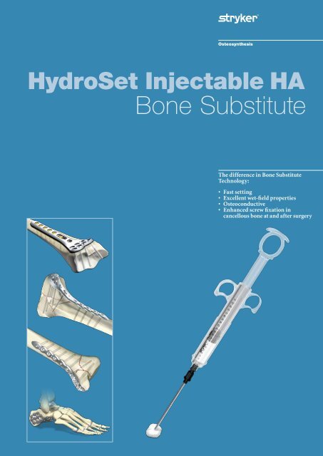 HydroSet Brochure - Stryker