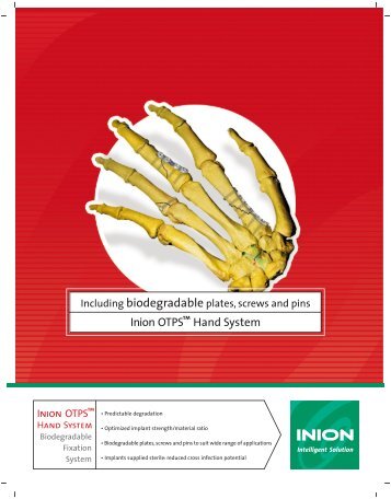 Inion OTPS™ Hand System - Stryker