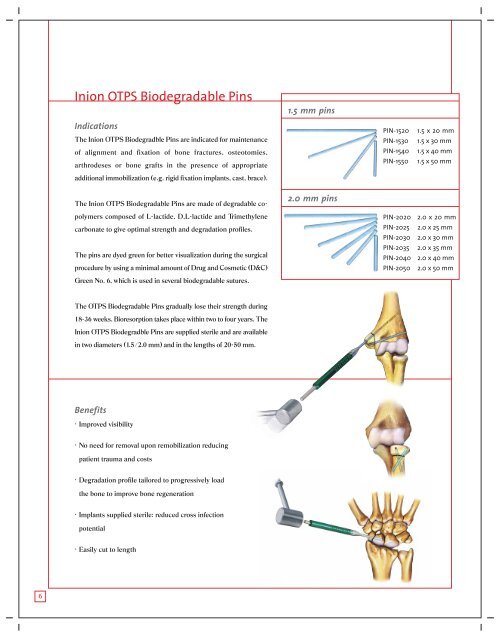 Inion OTPS™ Hand System - Stryker